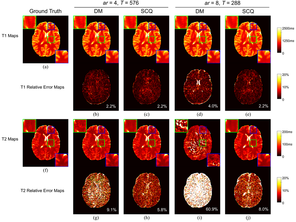 Deep learning for accelerated MR fingerprinting