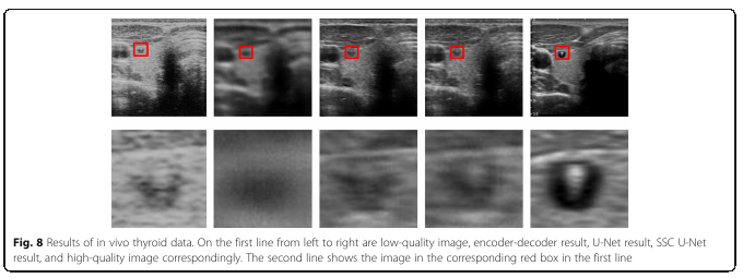 Portable ultrasound image reconstruction