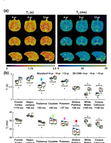 Preclinical MR fingerprinting of the macaque brain