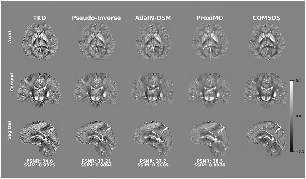 Proximal multi-operator QSM reconstruction