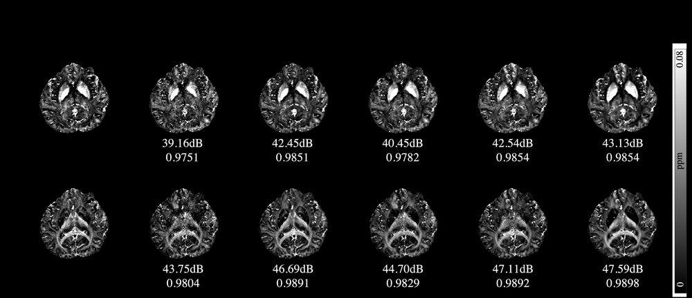 Wavelet source separation in susceptibility imaging